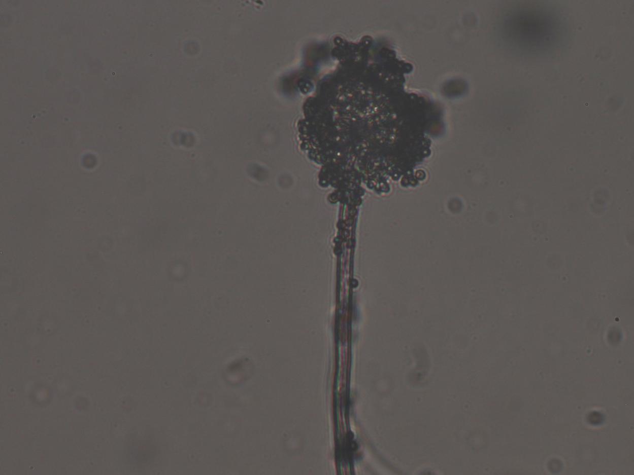 Imagen microscópica de Aspergillus de muestra tomada desde el cultivo