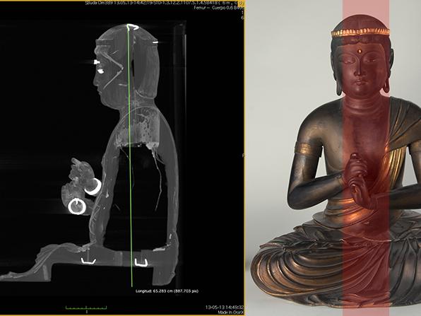 Tomografía computarizada cuerpo de Buda