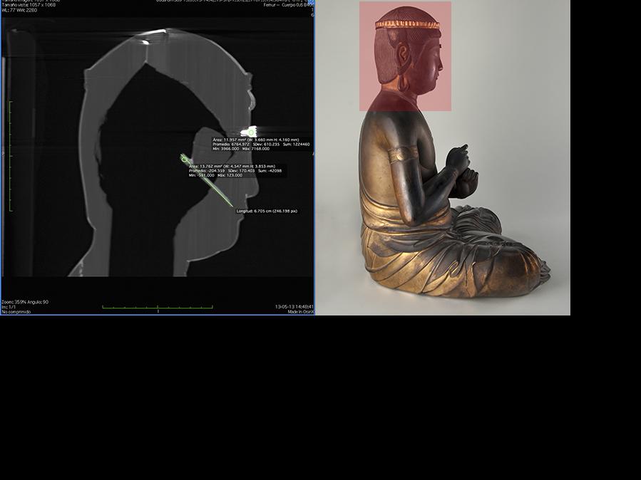Tomografía computarizada cabeza de Buda