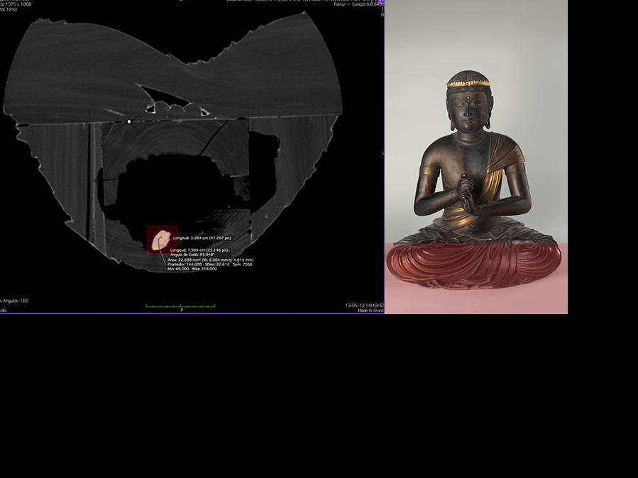 Tomografía computarizada parte inferior de Buda