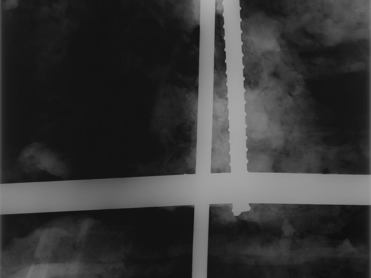 Detalle de elementos metálicos observados por Rayos X