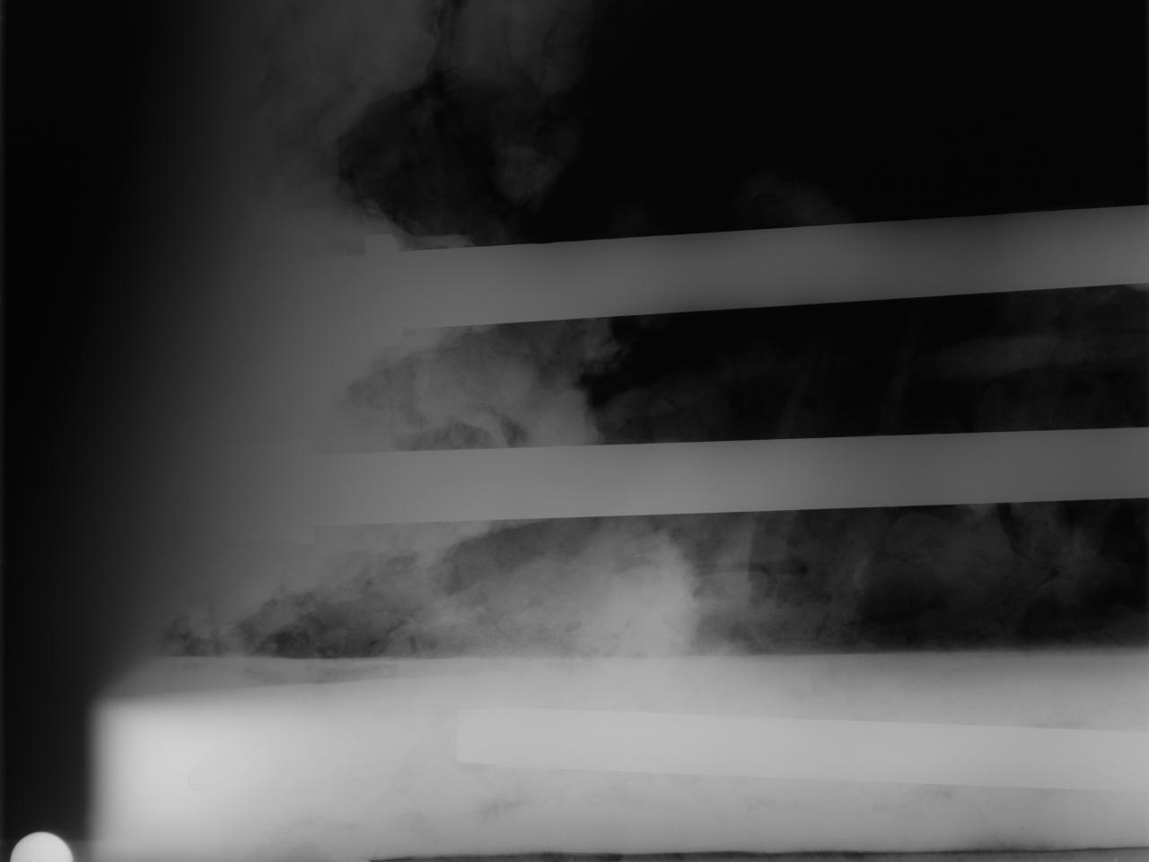 Detalle de la unión entre la barra metálica y el soporte mediante Rayos X