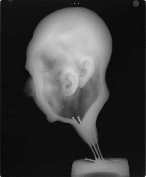 Estudio tecnológico a través de RX