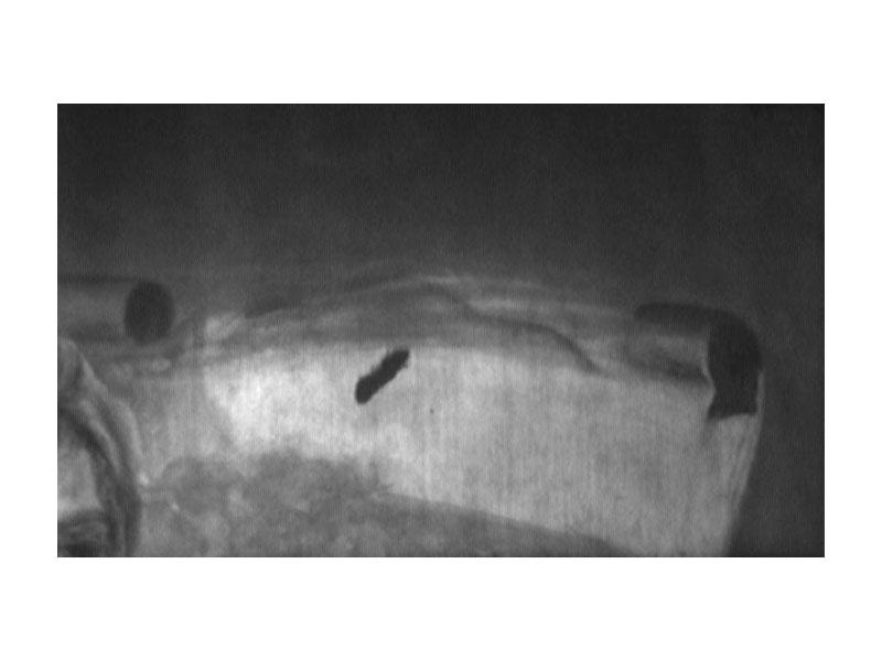 Transmitografía IR.