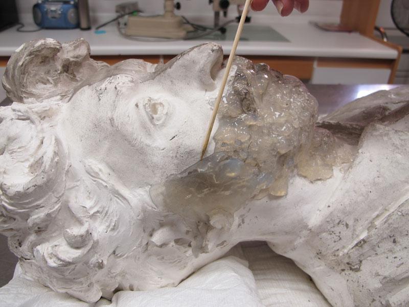 Aplicación de gel agar-agar.