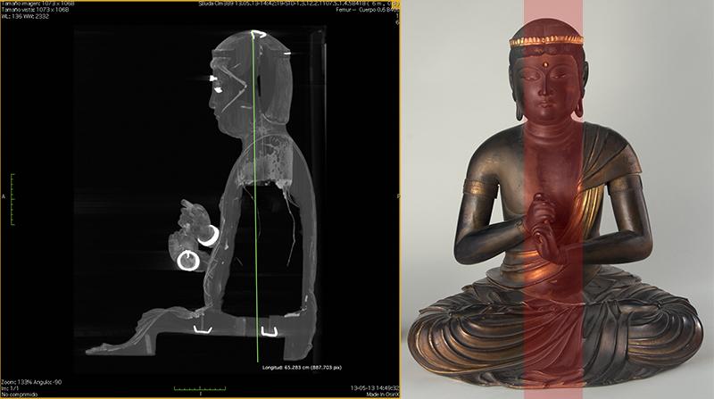 Tomografía computarizada cuerpo de Buda