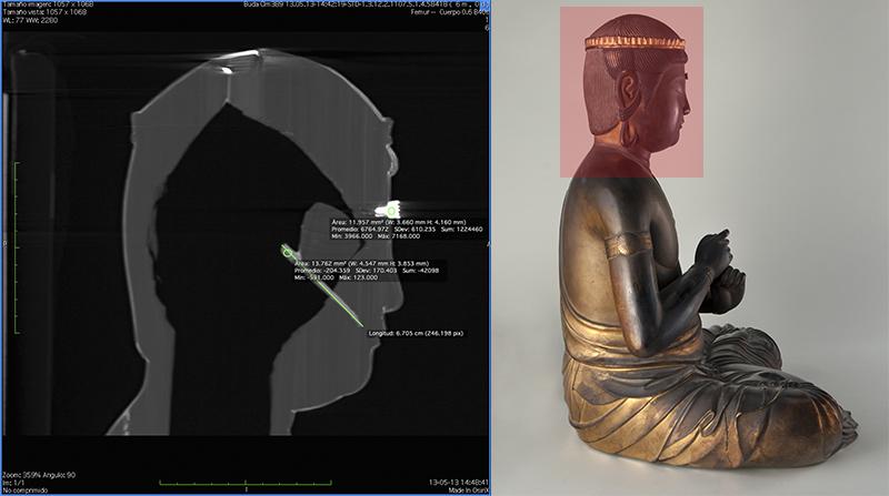 Tomografía computarizada cabeza de Buda