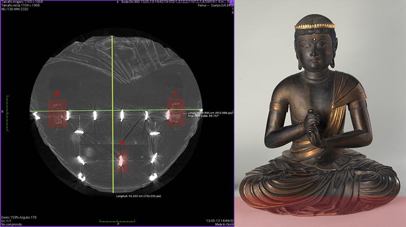 Tomografía computarizada (TAC)