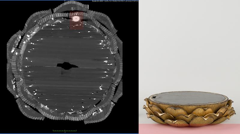 Tomografía computarizada base flor de loto