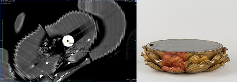 Tomografía computarizada base flor de loto