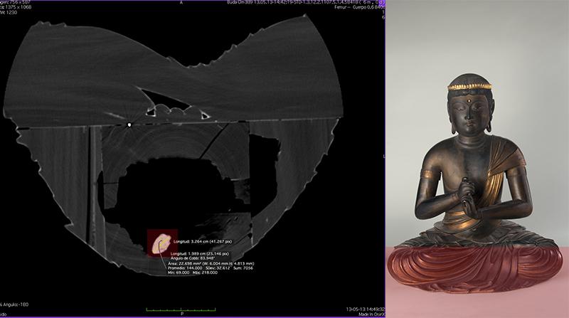 Tomografía computarizada parte inferior de Buda