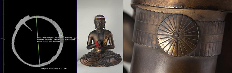 Tomografía computarizada pulsera