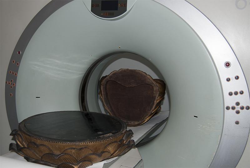 Tomografía computarizada (TAC)