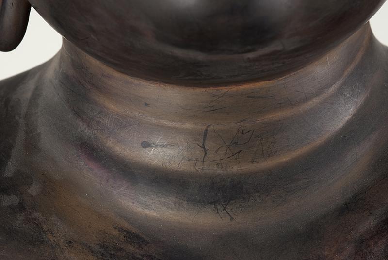 Pliegues en el cuello