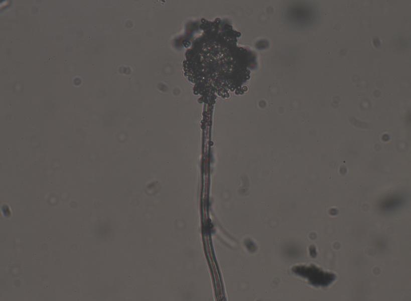 Imagen microscópica de Aspergillus de muestra tomada desde el cultivo