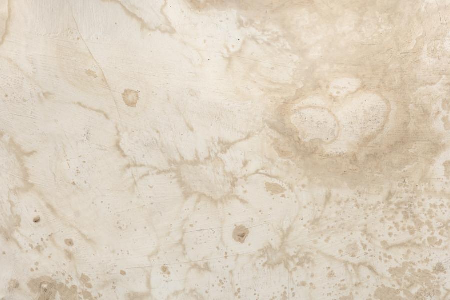 Manchas en forma de aureola en la zona del cuello