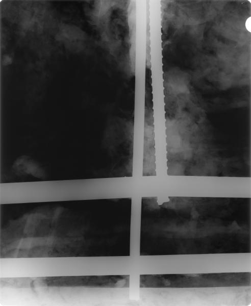 Detalle de elementos metálicos observados por Rayos X