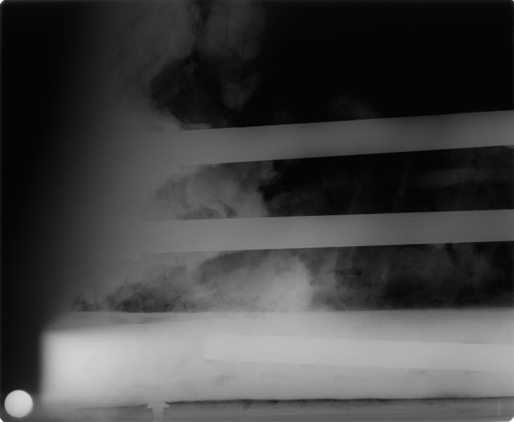 Detalle de la unión entre la barra metálica y el soporte mediante Rayos X